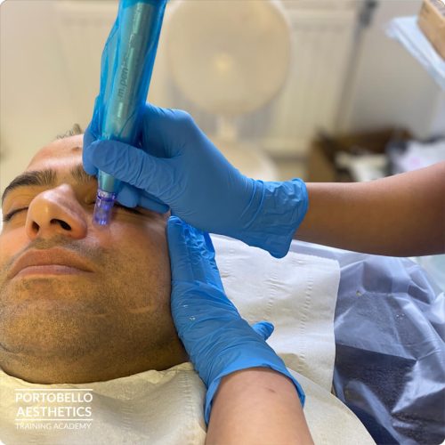 Level 4 microneedling training course Ladbroke Grove London academy